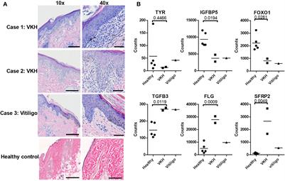 Case Series: Gene Expression Analysis in Canine Vogt-Koyanagi-Harada/Uveodermatologic Syndrome and Vitiligo Reveals Conserved Immunopathogenesis Pathways Between Dog and Human Autoimmune Pigmentary Disorders